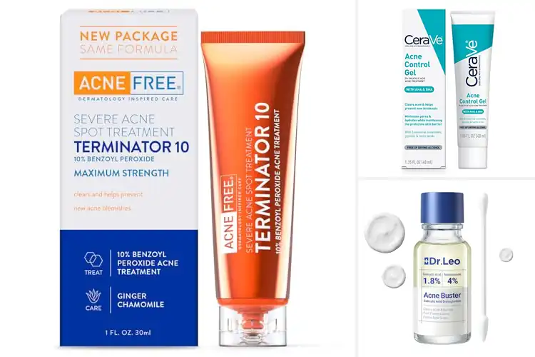 Detailed view of Best Acne Breakouts Treatments