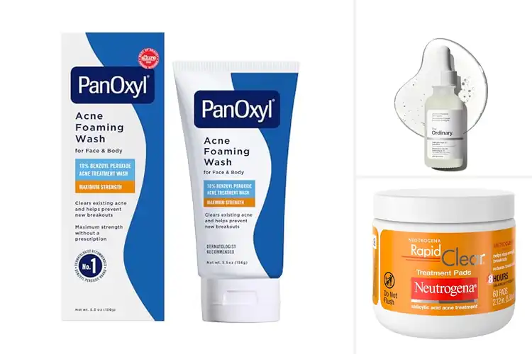 Detailed view of Best Acne Fighting Products