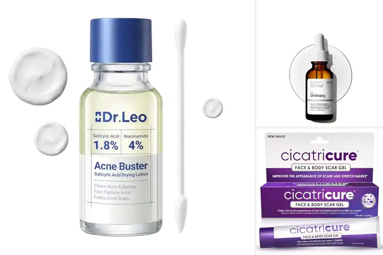 Detailed view of Best Acne Marks Treatments