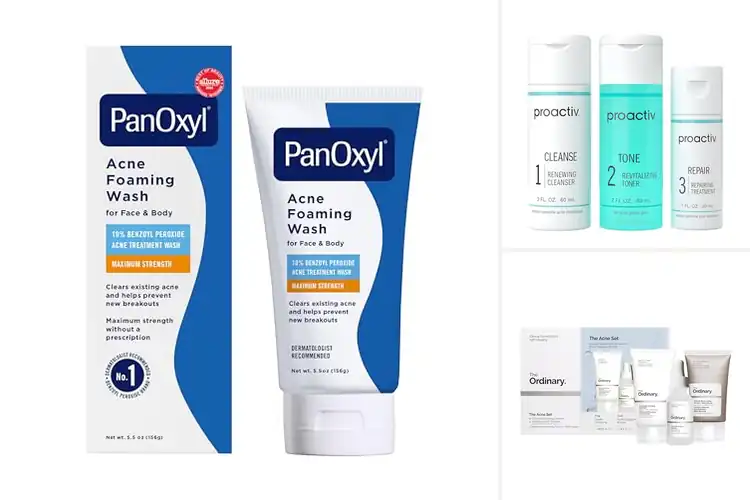 Detailed view of Best Acne Treatments: Clear Skin Solutions for Confidence