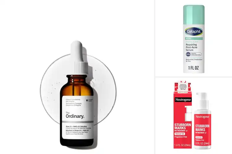 Detailed view of Best Post-Acne Mark Treatments